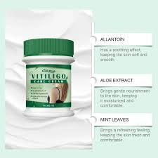 Vitiligo Herbal Aloe Vera & Mint Care Cream