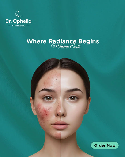 Anti Melasma Cream