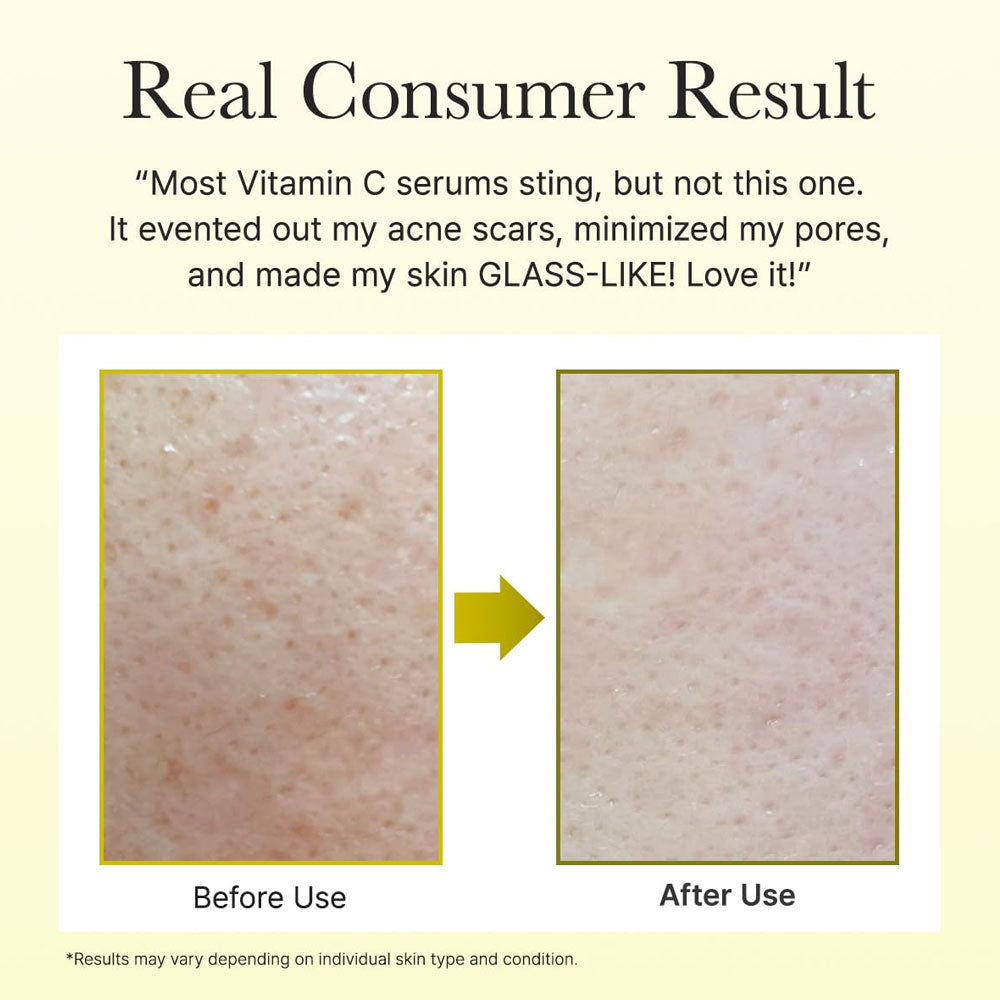Arencia Vitamin C Booster Shot (Buy 1 Get 1 Free)